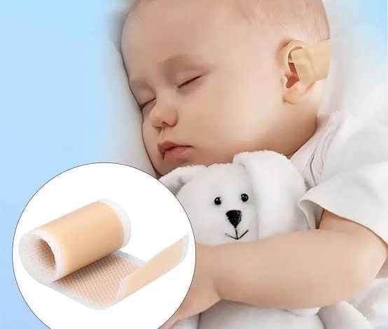 خرید چسب فرم دهی گوش نوزاد 4 در 100 سانت