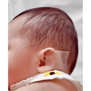خرید چسب فرم دهی گوش نوزاد 4 در 100 سانت